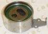 AUTOKIT 03.80165 Tensioner Pulley, timing belt